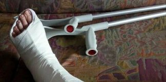 Füße ertragen viel Gipsfuss-stebo